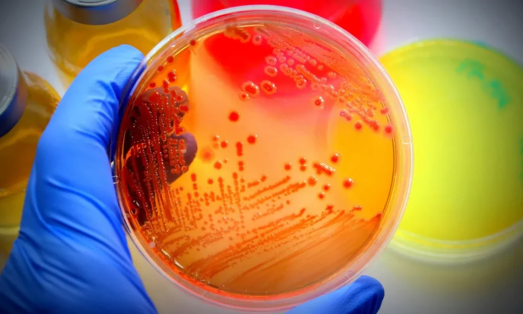 Escherichia coli