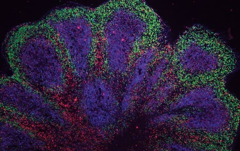 Crean mini cerebros de laboratorio para el tratamiento de enfermedades neurodegenerativas