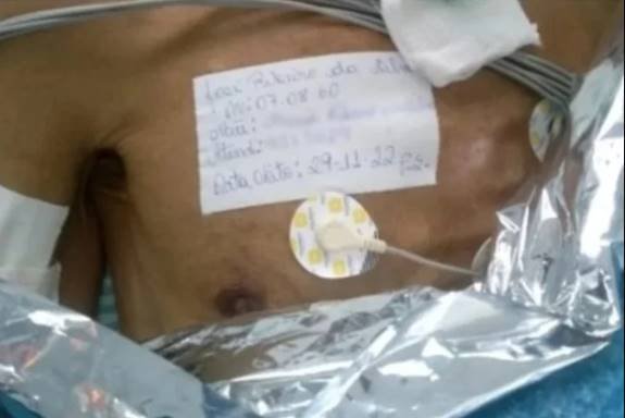José Ribeiro da Silva permaneció cinco horas dado por muerto