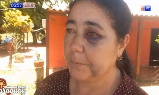Una mujer fue brutalmente golpeada y podría hasta perder el ojo