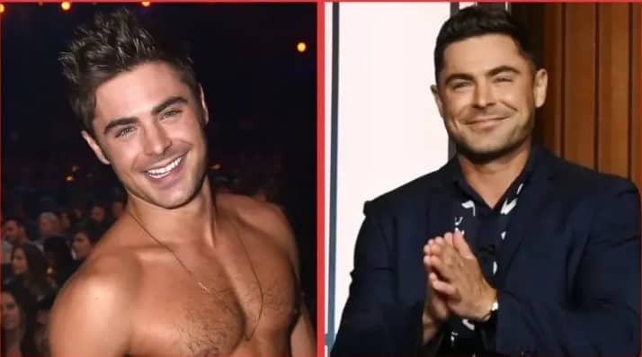 Zac Efron antes y después del accidente.