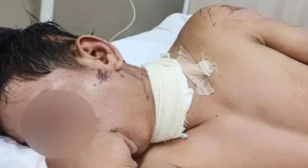 Alambre en plena calle casi decapita a motociclista