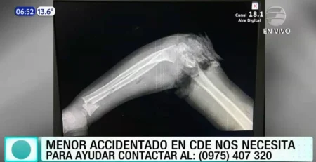 VIDEO: ¡Impactante! Niño de 2 años metió su brazo en una centrifugadora encendida Niño de 2 años metió su brazo en una centrifugadora encendida
