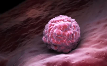 Principales hábitos asociados al cáncer
