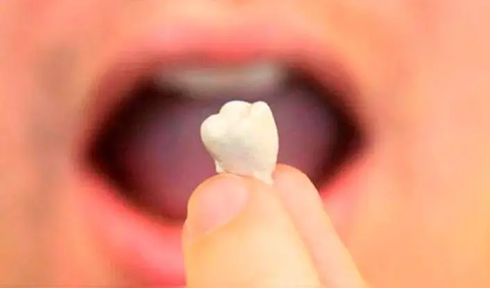 ¿Qué puede significar soñar que se te caen los dientes?